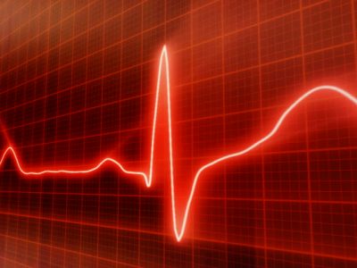 EKG-opšte karakteristike