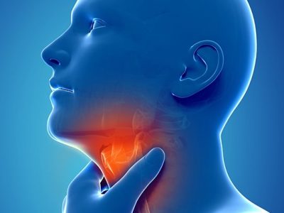 Terapija akutnog tonzilitisa – angina
