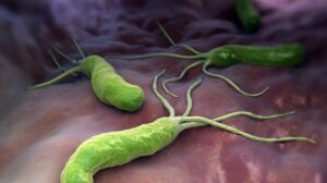terapija-helicobacter-pylori