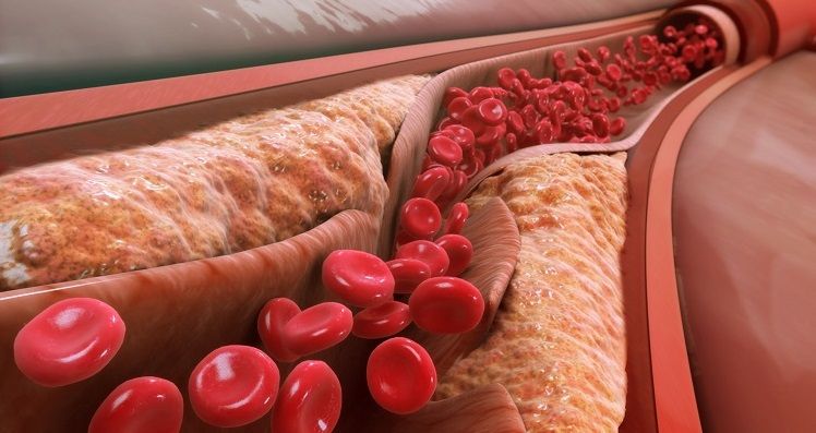 bolesti-krvnih-sudova-1