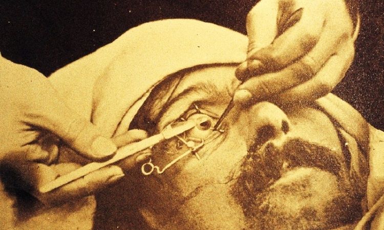 operacija-katarakte-datira-iz-vi-veka-12