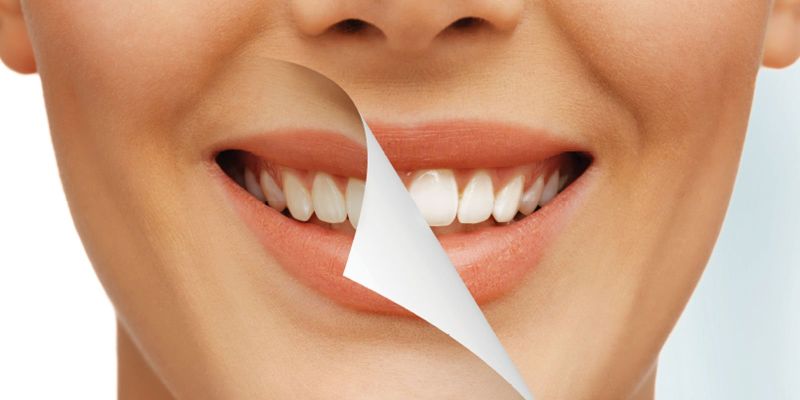 tretman-diskoloracije-endodontski-tretiranih-zuba