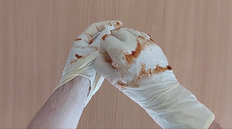 kako se skidaju rukavice